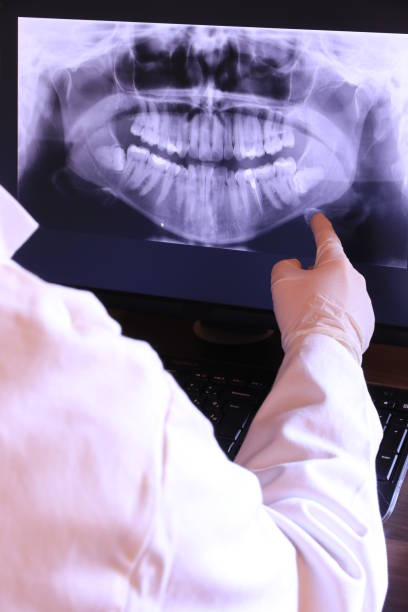 Best Emergency Dentist for Lost Fillings or Crowns in Finneytown, OH
